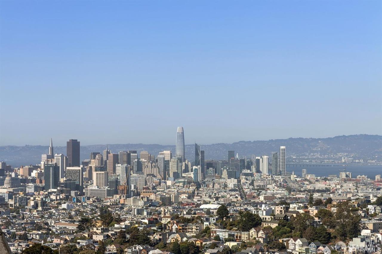 Detail Gallery Image 9 of 73 For 172 Portola Dr, San Francisco,  CA 94131 - – Beds | – Baths