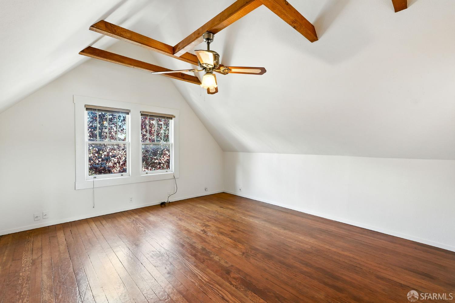 Detail Gallery Image 27 of 47 For 449 27th St, San Francisco,  CA 94131 - – Beds | – Baths