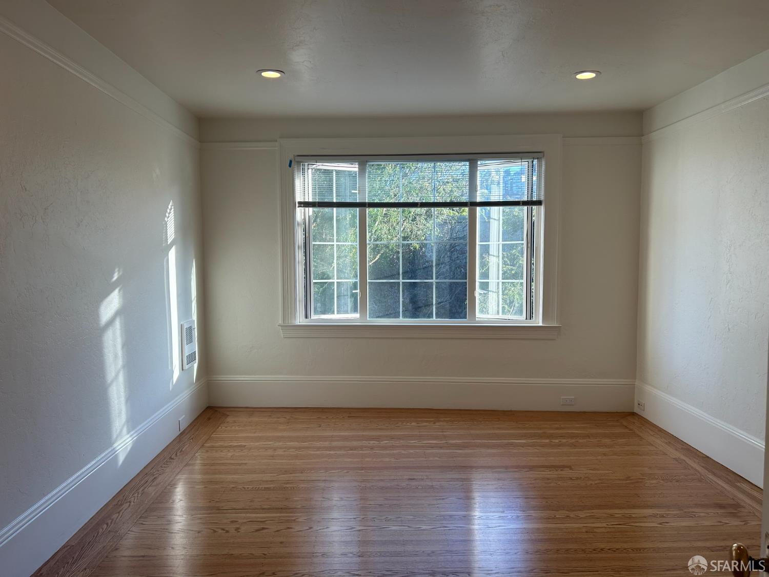 Detail Gallery Image 7 of 22 For 174 Corbett Ave, San Francisco,  CA 94114 - 1 Beds | 1 Baths