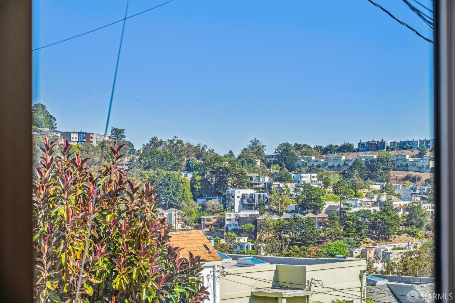 Detail Gallery Image 11 of 55 For 47 Melrose Ave, San Francisco,  CA 94131 - 3 Beds | 2 Baths