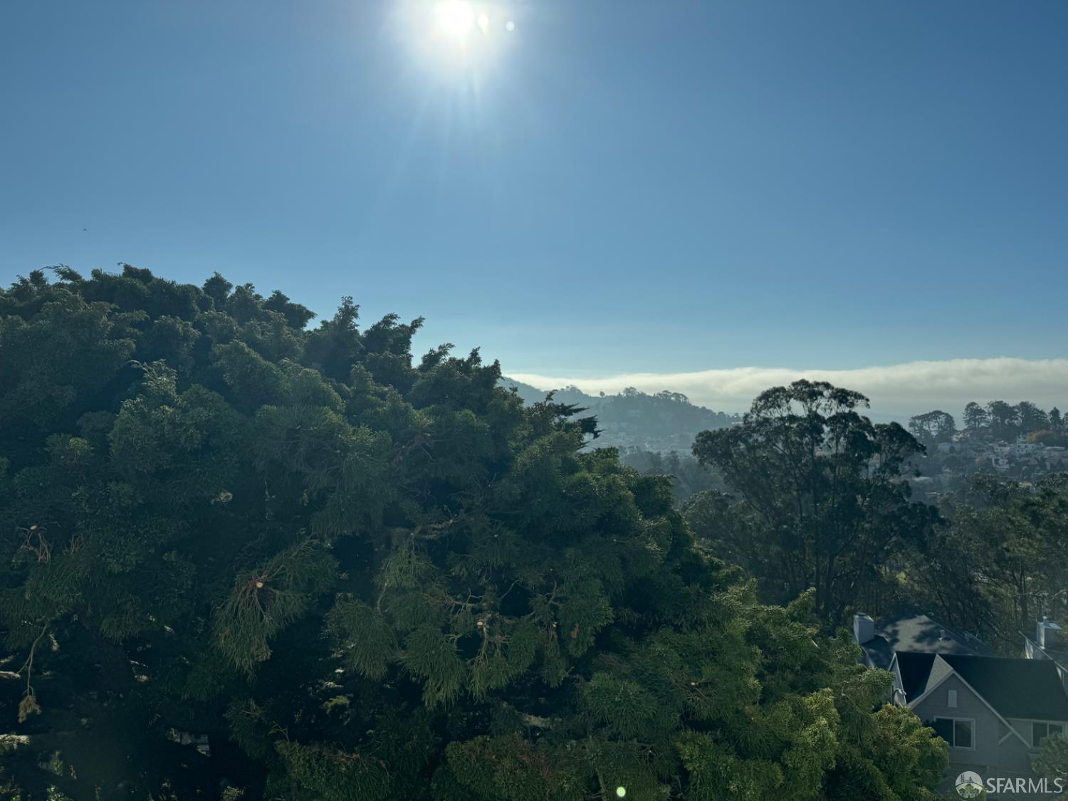 Detail Gallery Image 9 of 18 For 377 Oak Park Dr, San Francisco,  CA 94131 - 2 Beds | 2 Baths