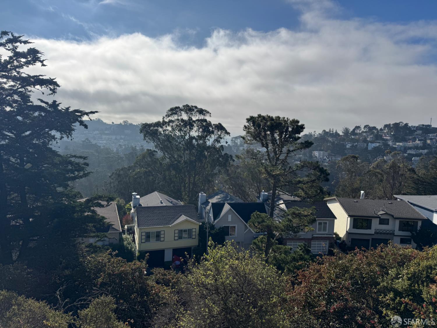 Detail Gallery Image 13 of 18 For 377 Oak Park Dr, San Francisco,  CA 94131 - 2 Beds | 2 Baths