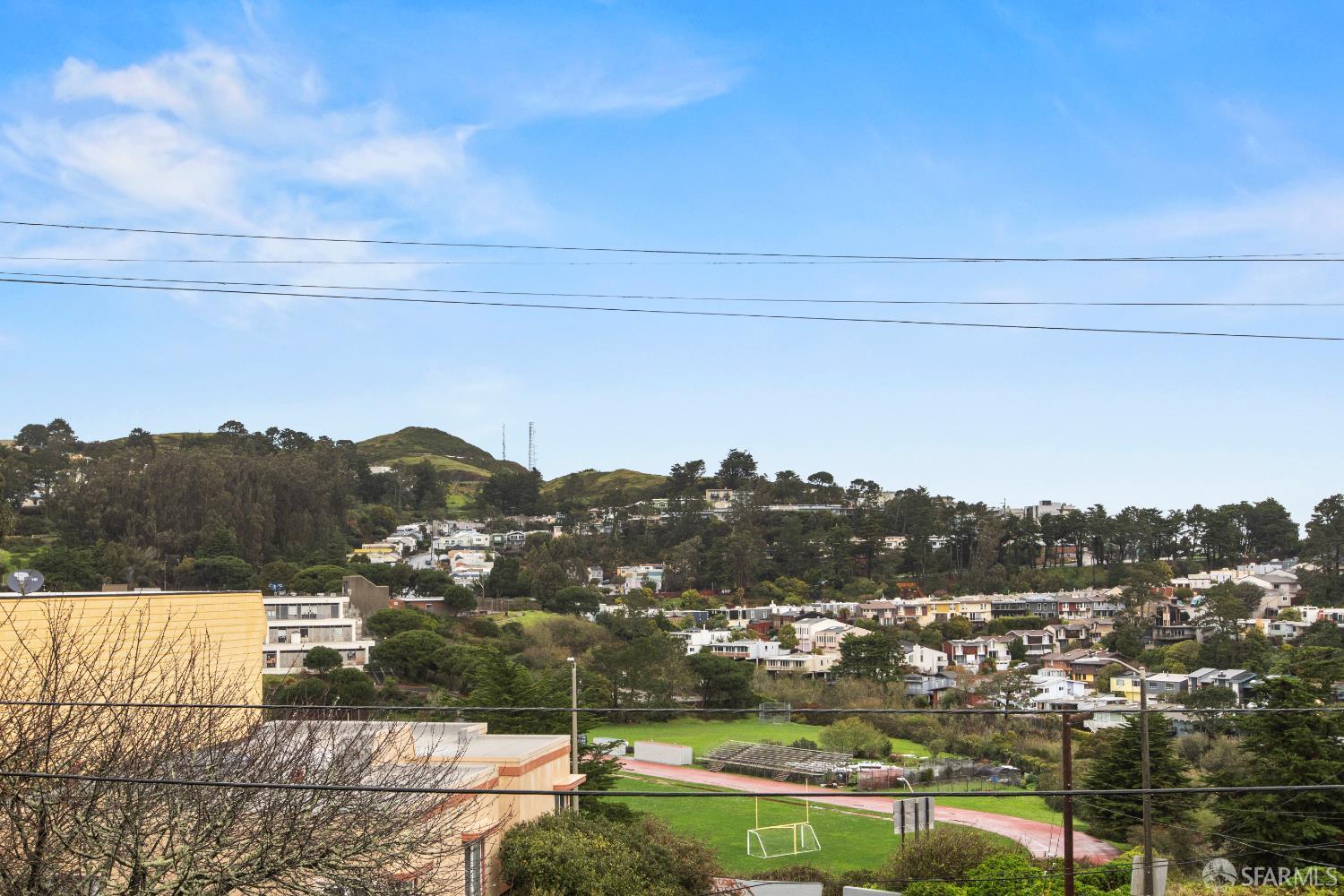 Detail Gallery Image 6 of 86 For 100 Encline Ct, San Francisco,  CA 94127 - 3 Beds | 2 Baths