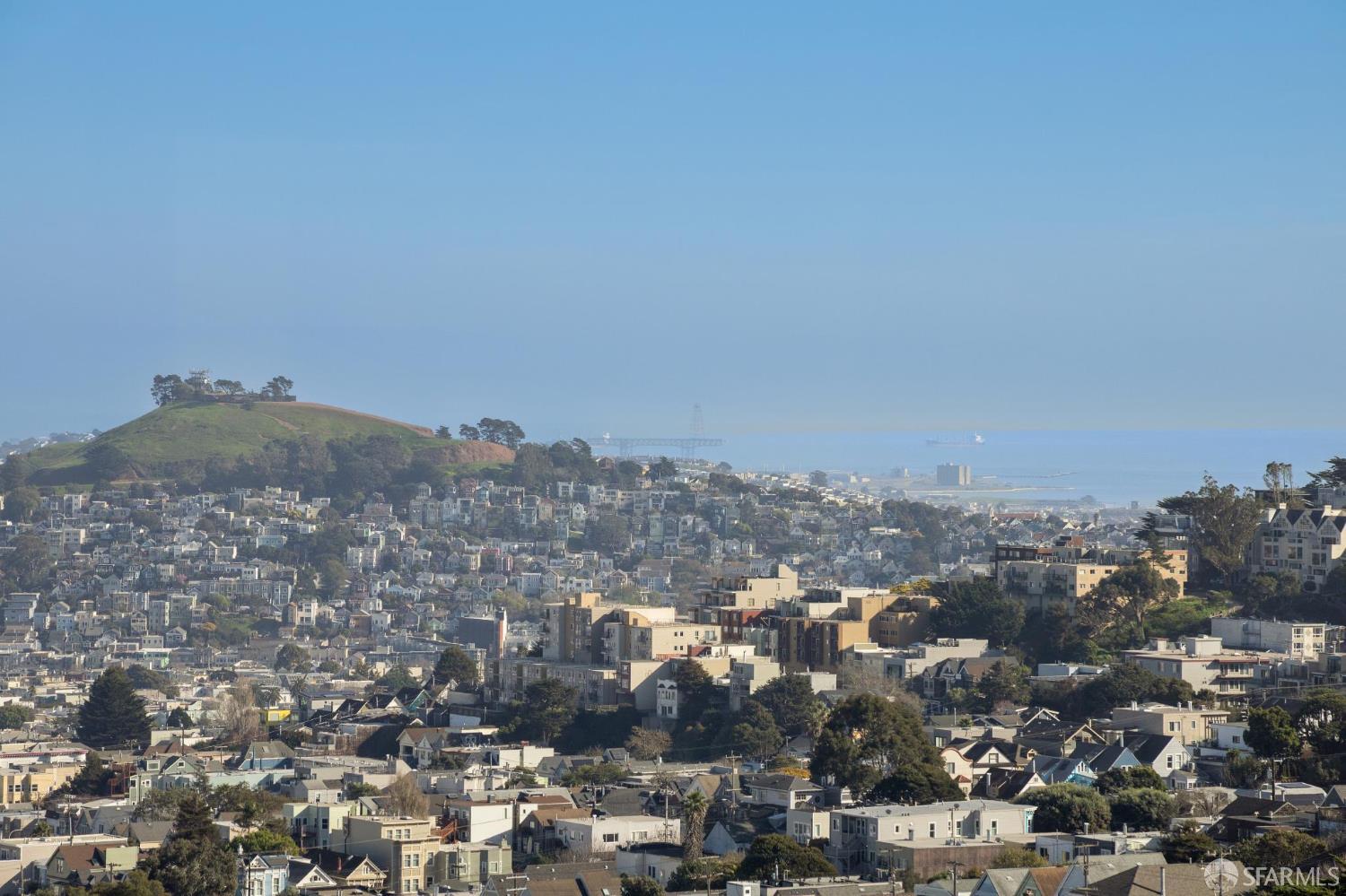 Detail Gallery Image 21 of 34 For 505 Grand View Ave #2ND,  San Francisco,  CA 94114 - 2 Beds | 2 Baths